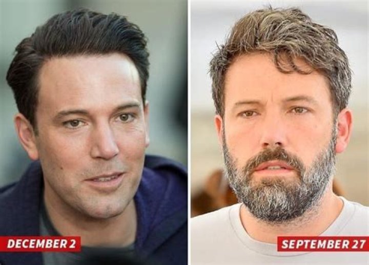 Ben Affleck Plastic Surgery 'Nightmare': Desperate Attempt Look Youthful?