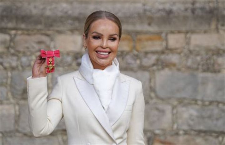 Katie Piper Biography: Age, Net Worth, Instagram, Spouse, Height, Wiki, Parents, Siblings, Children, Awards