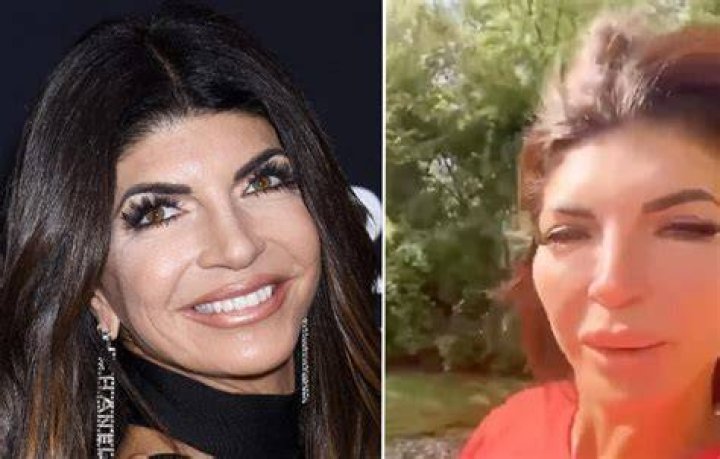 Teresa Giudice Plastic Surgery Shocker: RHONJ Star Won’t Admit To Secrete Hairline Surgery?